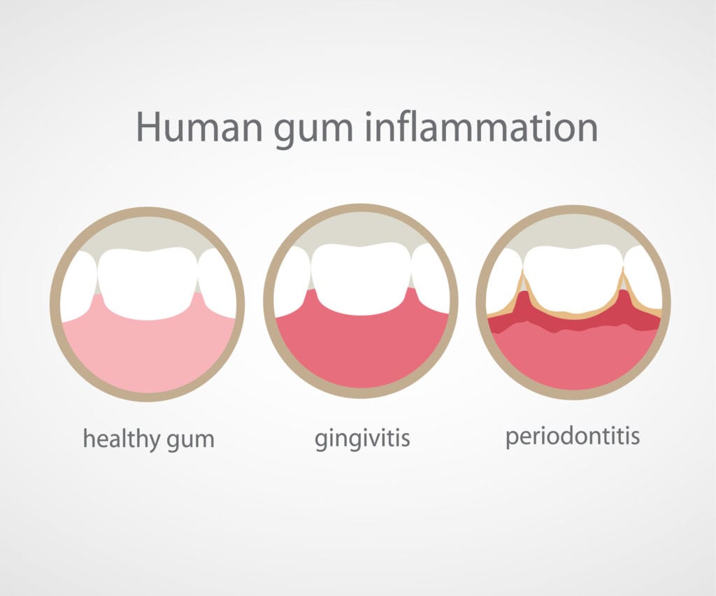 What Those Numbers the Dentist Calls Out Really Mean